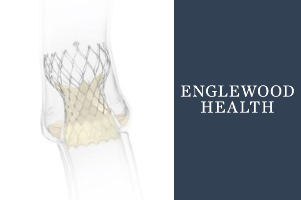 Englewood Health Selected as Clinical Trial Site for Expanding TAVR Applications