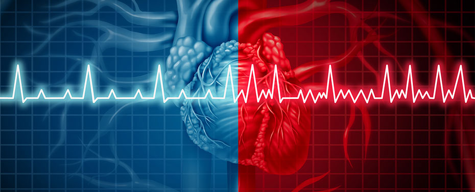 illustration of electrical signals in the heart