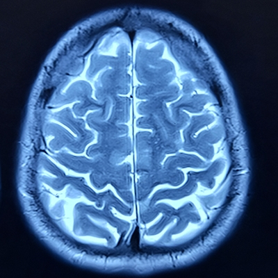 Brain scan