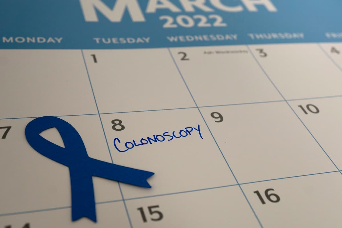 colonoscopy marked on a calendar